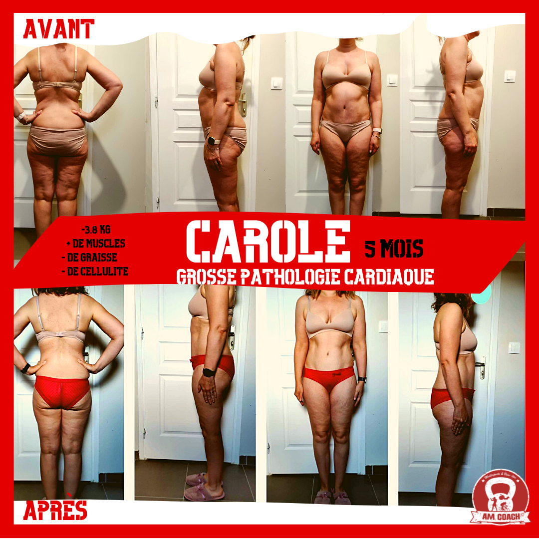 Avant et après — Carole : -12 kg en 5 mois